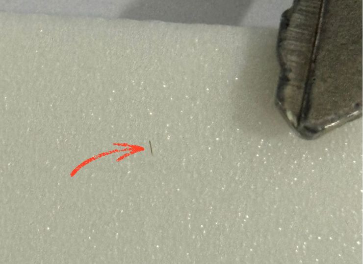 Corpo estranho metálico que entrou no olho da motociclista