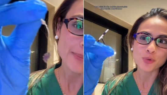 Ginecologista encontra pelos de gatos em DIU de paciente