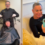 Gretchen faz transplante capilar em Vitória e revela luta contra alopecia