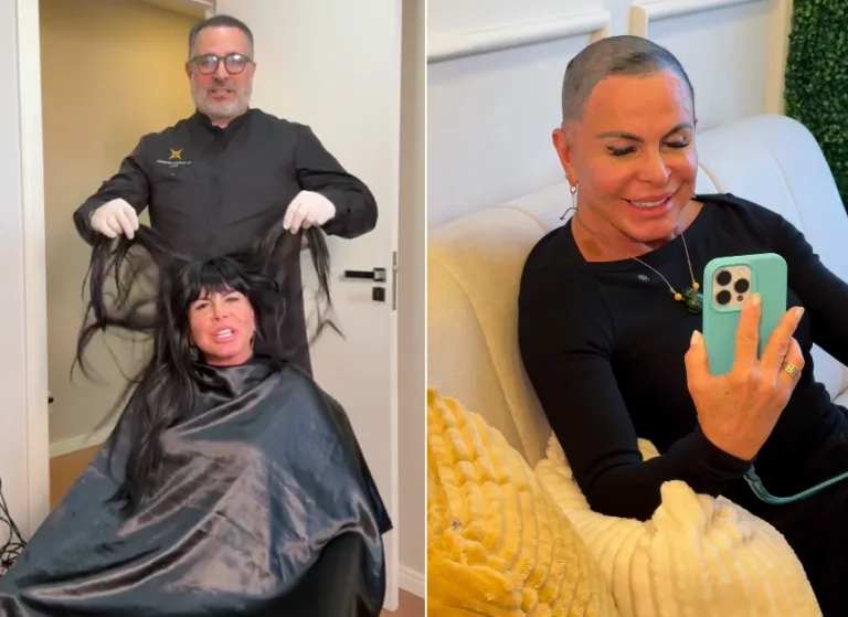 Gretchen faz transplante capilar em Vitória e revela luta contra alopecia